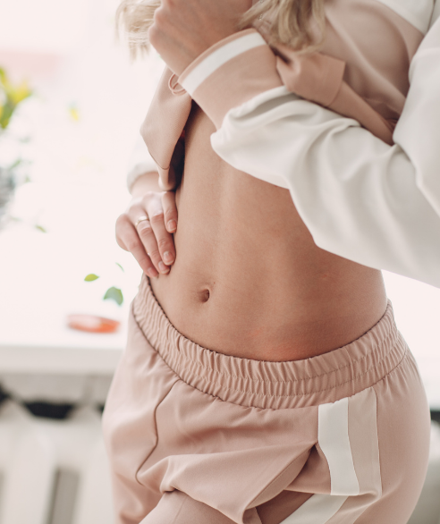 Resultado de mini abdominoplastia — Dr. Marco Vricella