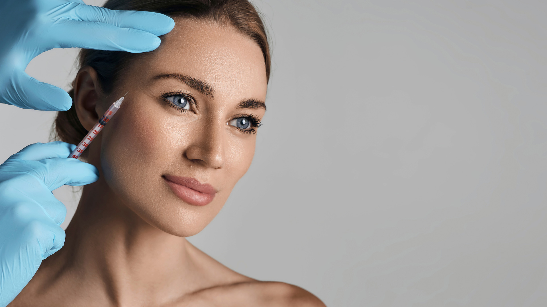 Resultado de lifting facial y de cuello — Dr. Marco Vricella