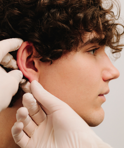 Resultado de otoplastia — Dr. Marco Vricella